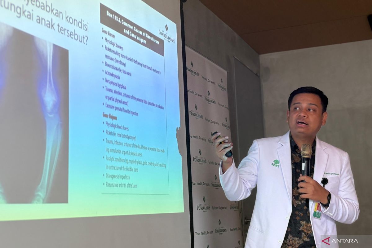 Kurang vitamin D jadi penyebab umum anak alami kelainan bentuk kaki