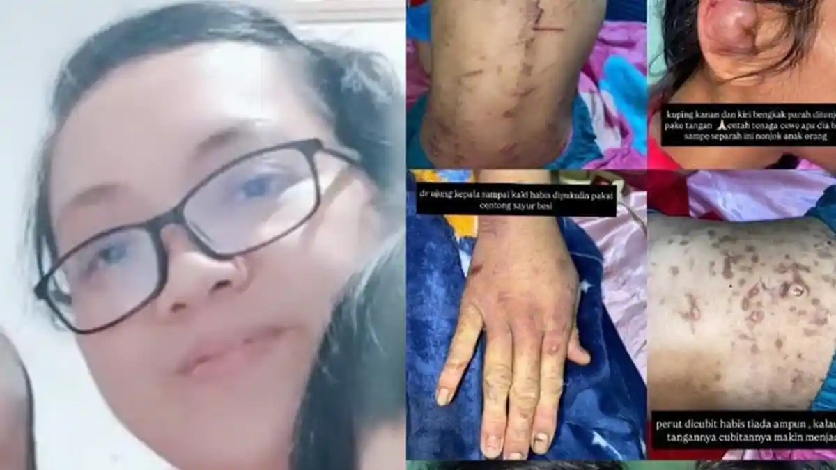 Cara Sadis ASN BPK Siksa ART di Bogor, Pukul Pakai Centong, Cubitannya Bikin Perut Korban Penuh Luka