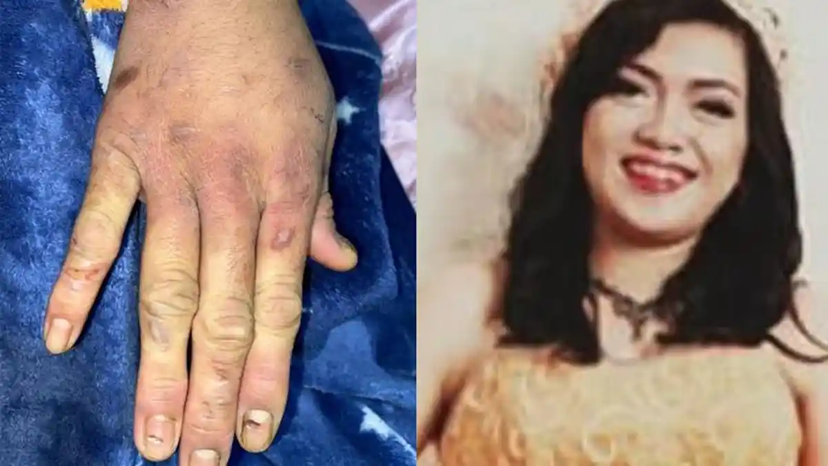 Deret Fakta Kasus ART di Gunungputri Bogor Dianiaya ASN BPK, Alasan Korban Disiksa Ternyata Sepele